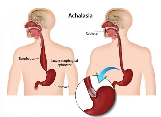 diagnostic