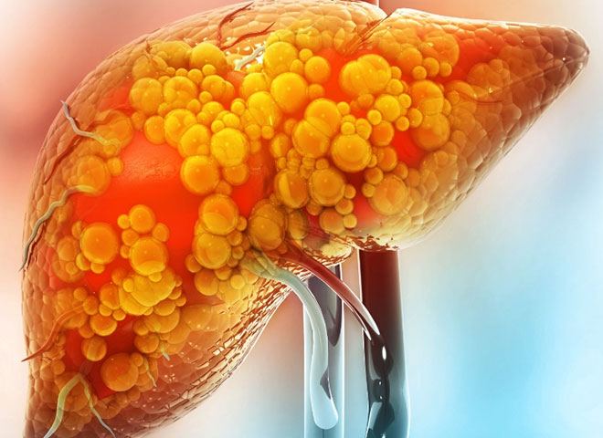 book gastroenterologist Bathinda