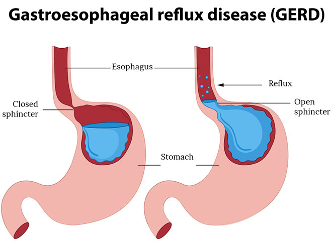 liver disease treatment Bathinda