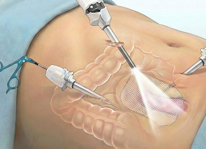 best gastroentero logist in Bathinda