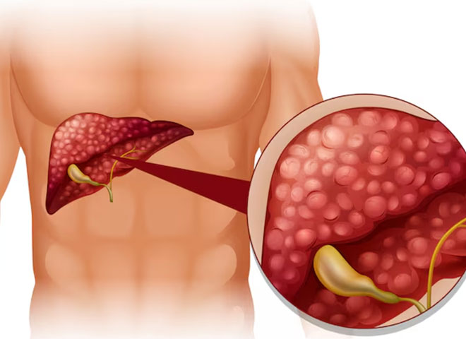 endoscopy in Bathinda