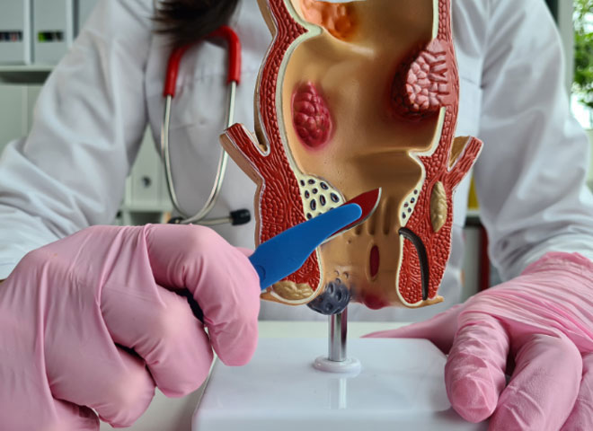 acidity treatment Bathinda