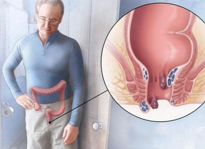 colonoscopy in Bathinda